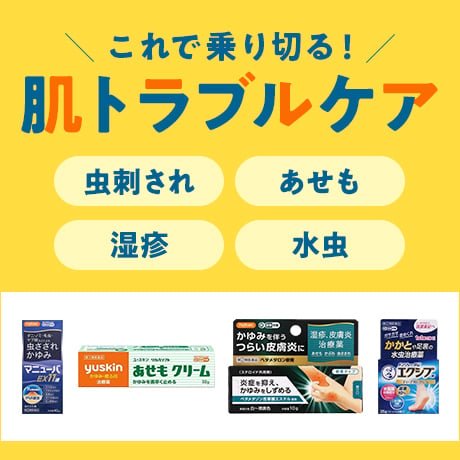 これで乗り切る！肌トラブルケア 虫刺され あせも 湿疹 水虫