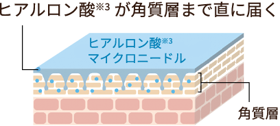 ヒアルロン酸※3が角質層まで直に届く ヒアルロン酸※3マイクロニードル 角質層