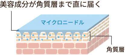 美容成分が角質層まで直に届く マイクロニードル 角質層
